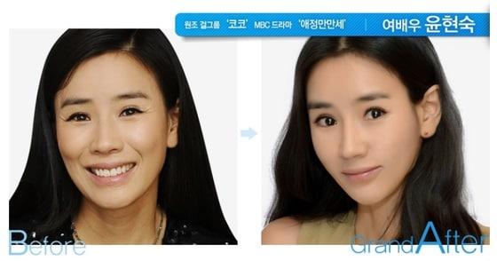 본문 이미지 - 그랜드성형외과 홈페이지 © News1 