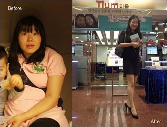 본문 이미지 - 다이어트 전후의 황규림씨(정종철 트위터) © News1 