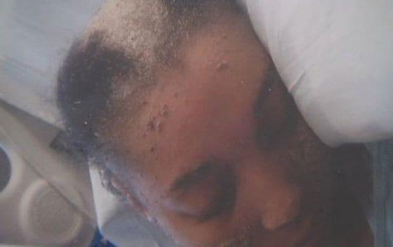 본문 이미지 - 머리에서 손톱이 자라는 미국 여성 사니나 이솜(28) (허핑턴포스트)© News1  