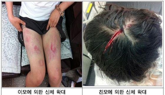 본문 이미지 - 서울시 제공. © News1 