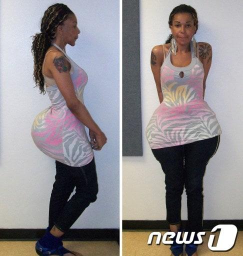 본문 이미지 - 오닐 론 모리스© AFP=뉴스1 