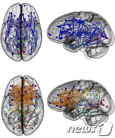 본문 이미지 - 남성(위)과 여성의 뇌 신경망도. 남성은 좌·우 각 뇌 안에서 앞뒤 간 연결이 많은 반면 여성은 좌·우뇌 간 연결이 많다.(자료제공=미국 국립과학협회보)© News1 