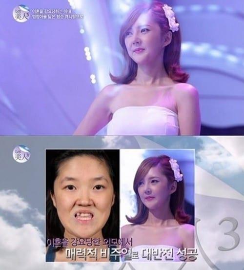 본문 이미지 - 스토리온 '렛미인3'에 출연한 김은애씨. © News1 