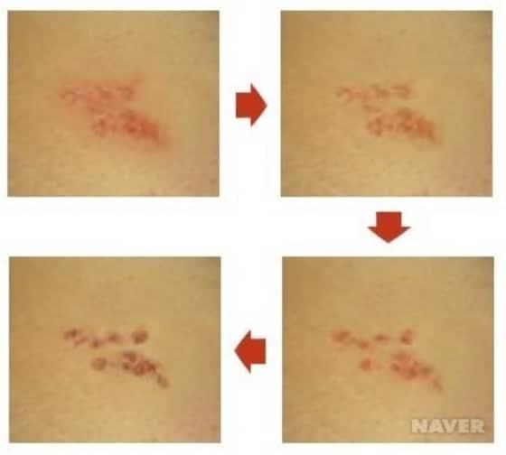 본문 이미지 - 사진 출처: 네이버