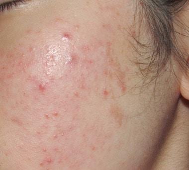 본문 이미지 - ⓒ News1