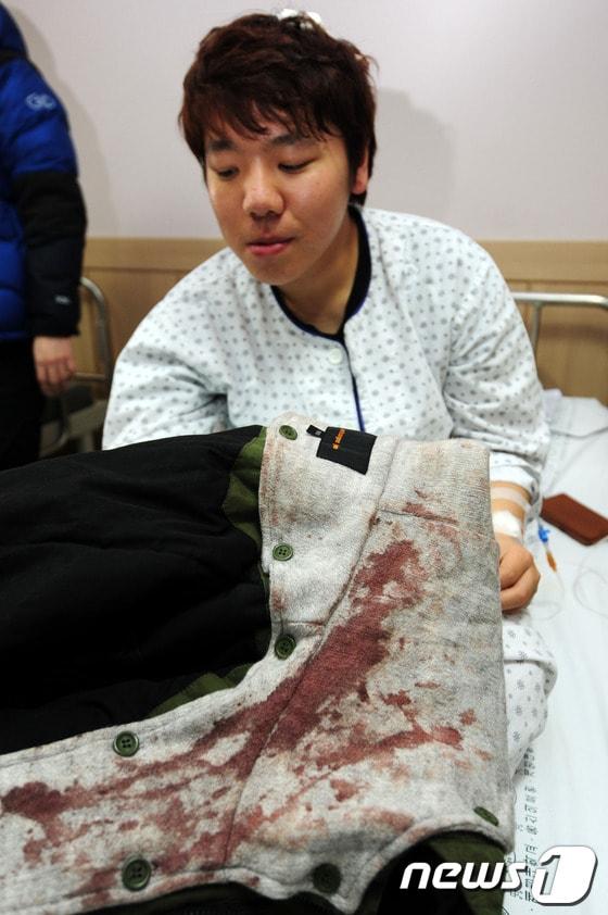 본문 이미지 - 경주 리조트 붕괴사고로 머리를 다친 부산외대 이모&#40;19&#41;군이 사고 당시 입었던 피묻은 옷을 보여주며 상황을 설명하고 있다./최창호 기자© News1 