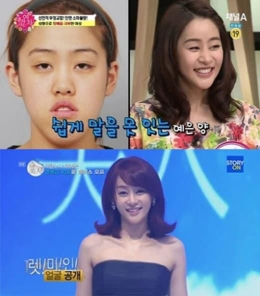 본문 이미지 - 채널A '혼자 사는 여자'© News1  