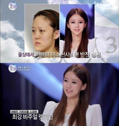 본문 이미지 - '렛미인' 방미정 근황, 사진 온스타일 '렛미인4' 방송 캡처. © News1  