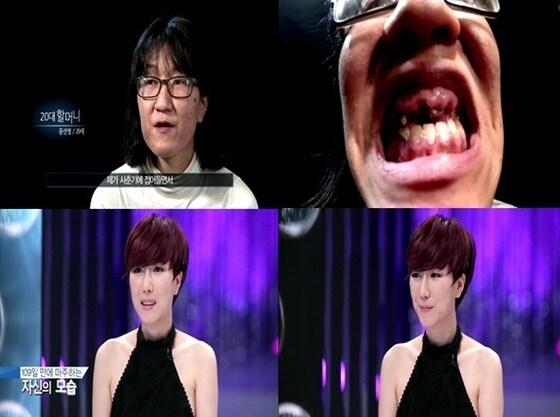 본문 이미지 - 20대 할머니로 불린 렛미인 도전자가 새 삶을 찾았다. © 스토리온 '렛미인4' 캡처