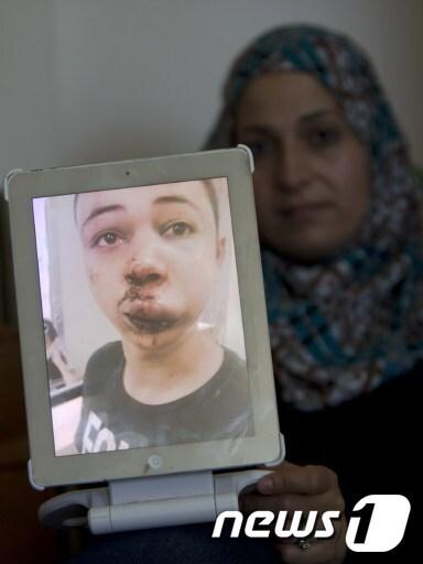 본문 이미지 - 팔레스타인계 미국인 소년 타리크 아부 크데르(15)의 모친이 자기 아들이 이스라엘 경찰에게 구타당한 모습을 찍은 사진을 5일(현지시간) 공개하고 있다. © News1 