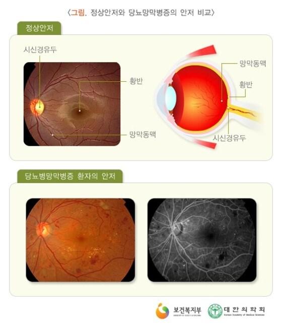 본문 이미지 - 보건복지부 제공