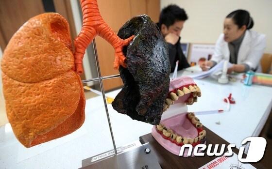 본문 이미지 - 서울 강남구보건소 금연클리닉을 찾은 흡연자들이 금연 상담을 받고 있다. 구청 보건소 금연클리닉에서는 일산화탄소 검사를 통해 흡연자로 확인되면 금연방법과 함께 니코틴이 들어 있는 패치와 사탕, 껌 등 금연 보조제를 지급하고 금연 이침(耳鍼) 진료 등의 한방 진료를 지원한다. /뉴스1 ⓒ News1 오대일 기자