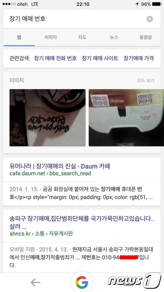 본문 이미지 - 장기매매 전단 스티커.ⓒ News1