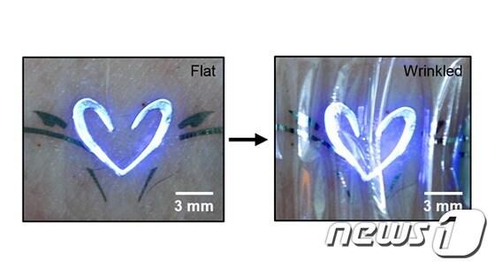 본문 이미지 - 이번에 개발된 QLED 소자는 매우 얇아 피부에 부착이 가능하고 저전압에서도 고성능을 보인다. (사진제공=미래부)ⓒ News1