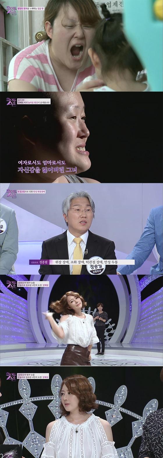 본문 이미지 - JTBC 화이트스완 6화 양혜원 (사진제공 신데렐라 성형외과)ⓒ News1