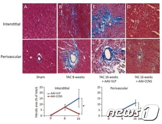 본문 이미지 - 심장 섬유화를 유발시킨 생쥐의 심장에 CCN5를 전달했을 때, 심장 섬유화가 회복되는 과정을 보여주는 심장 사진들(상단 A~D). 세포사이사이와 혈관 주위의 콜라겐 축척 정도를 볼 수 있다. (지스트 제공) 2016.3.29ⓒ News1