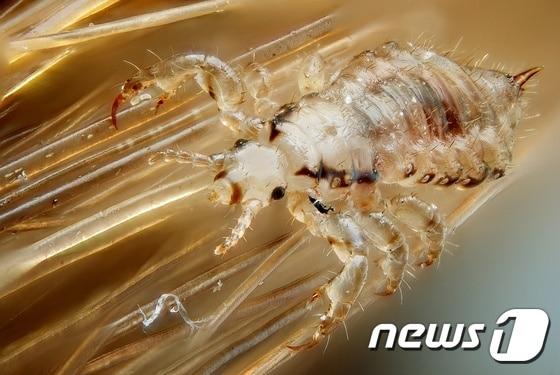 본문 이미지 - 머릿니ⓒ News1