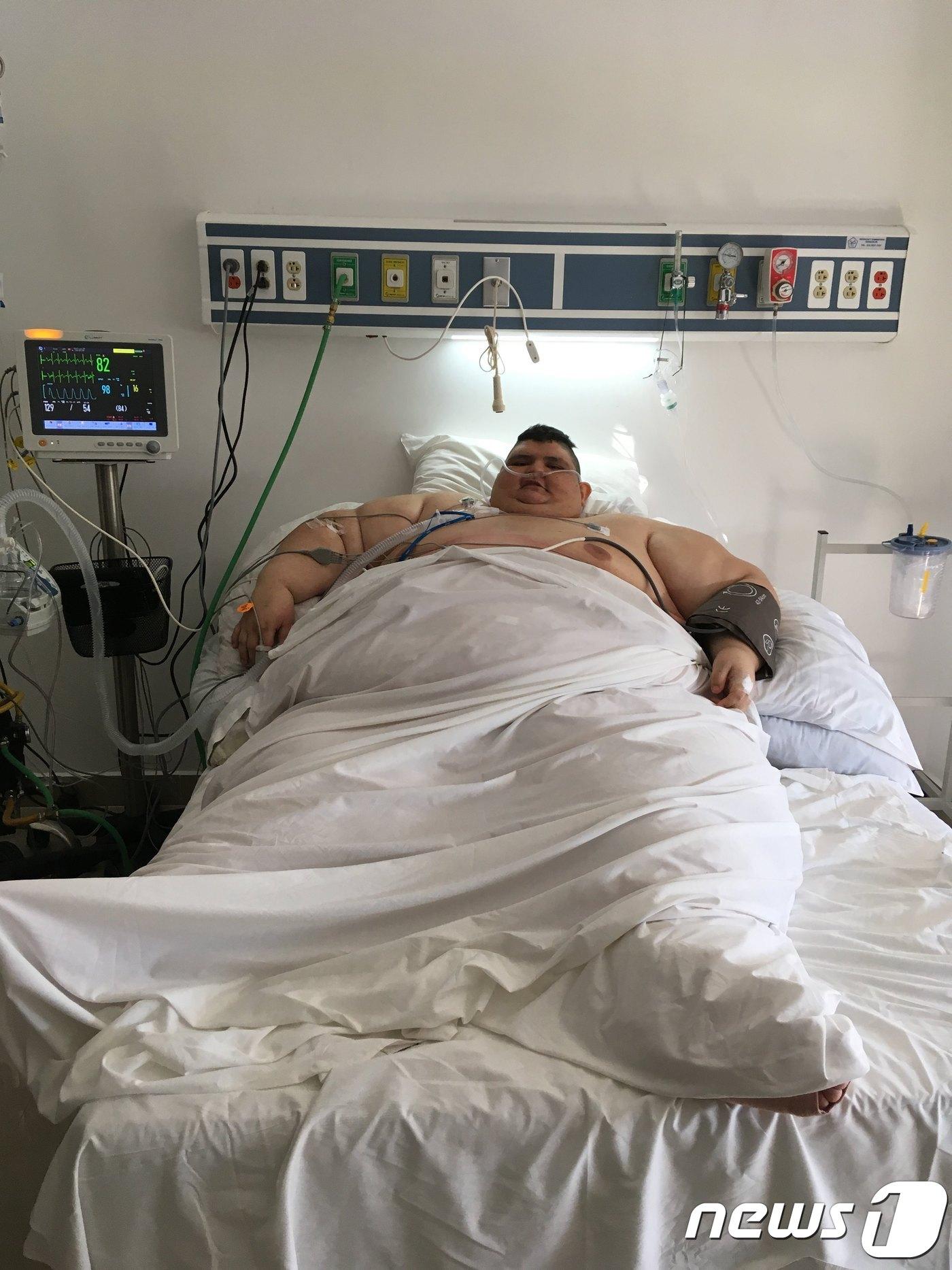 본문 이미지 - 23일(현지시간) 세계에서 가장 뚱뚱한 남자 후안 페드로 프랑코(33)가 두 번째 위 절제술을 받고 멕시코의 한 병원에서 회복하고 있다. ⓒ AFP=뉴스1