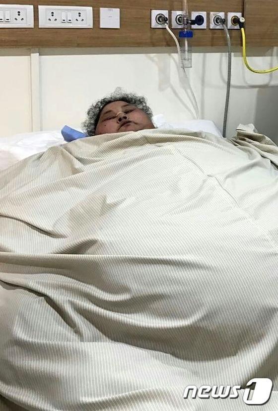 본문 이미지 - 에만 아흐메드 아브드 엘 아티(37)가 병원에서 휴식을 취하고 있다. 지난 3월초 수술 전 모습이다 ⓒ AFP=뉴스1