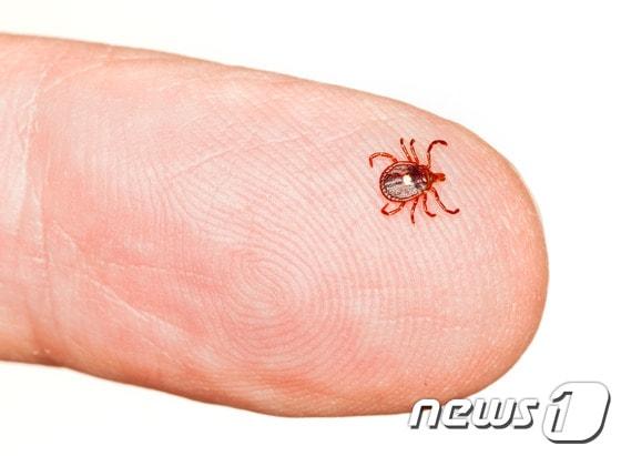 본문 이미지 - 수의사들은 "반려견 몸에 붙은 진드기를 맨손으로 떼선 안 된다"고 경고한다. (사진 이미지투데이) ⓒ News1