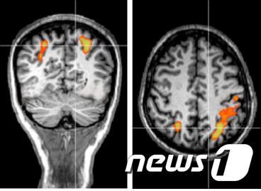 본문 이미지 - 운전, 게임 등 복잡한 시각정보 처리과정은 뇌의 뒤쪽 정수리에 있는 후두정엽이라는 부위에서 처리된다는 사실이 밝혀졌다. 사진의 밝은 연두색 부분이 후두정엽 내의 두정엽내고랑으로 뒤와 위에서 각각 촬영한 것이다.(한국뇌연구원 제공)ⓒ News1