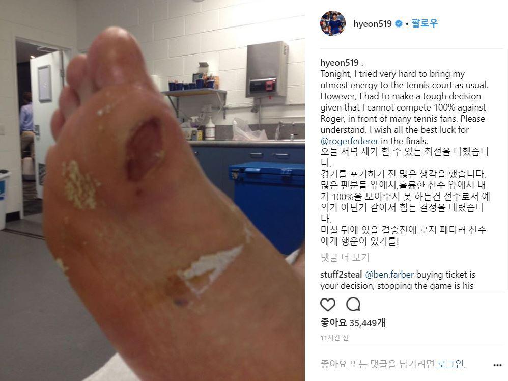 본문 이미지 - 정현이 26일(한국시간) 로저 페더러와의 호주오픈 4강전을 마친 뒤 자신의 SNS에 오른발 발바닥에 물집이 잡힌 사진을 올렸다. (정현 인스타그램 갈무리)ⓒ News1