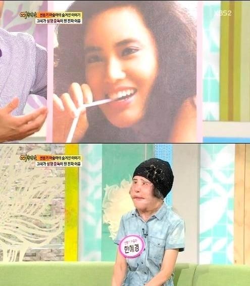 본문 이미지 - '선풍기 아줌마' 한혜경씨/사진=KBS 캡처 ⓒ News1