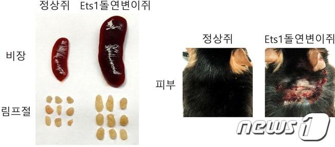 본문 이미지 - Ets1 유전자 변이로 인해 나타나는 루푸스 증상(IBS 제공)ⓒ News1