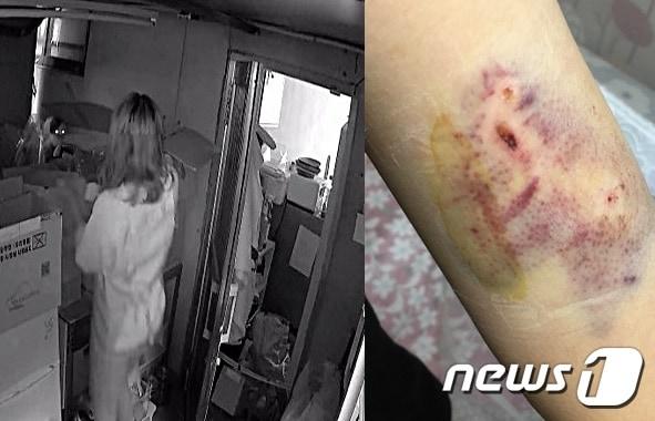 본문 이미지 - 한종희씨는 최근 카페 창고에서 물건을 꺼내려고 상자에 손을 댔다가 길고양이에게 습격을 당했다. ⓒ News1