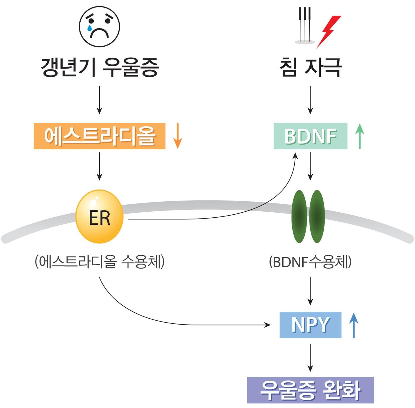 본문 이미지 - 한의학 침 치료의 갱년기 우울증 치료효과 모델.ⓒ News1