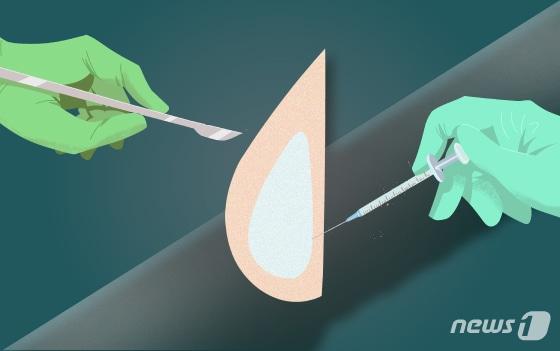 본문 이미지 - ⓒ News1 DB