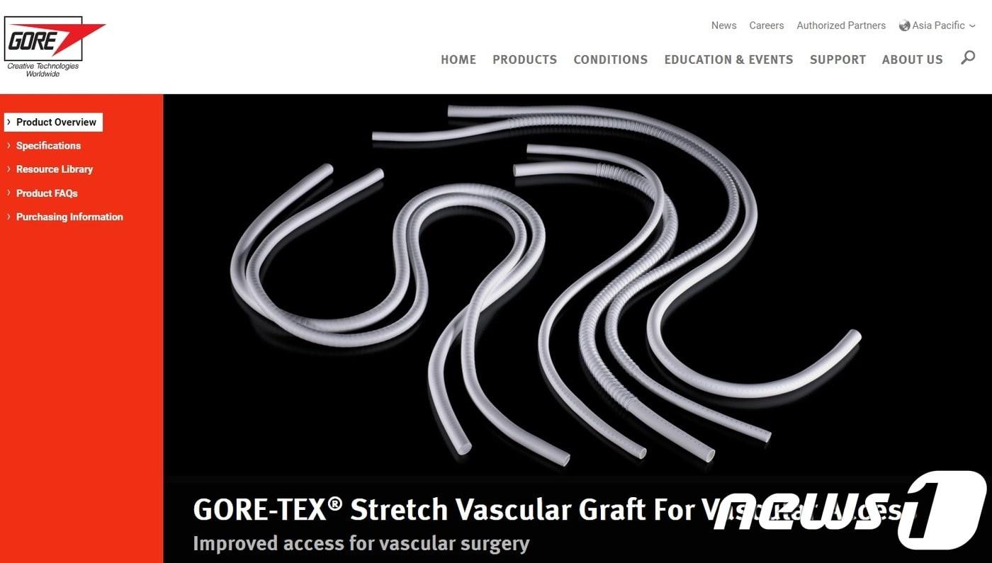 본문 이미지 - 고어 사에서 생산하는 인공 혈관 (고어 사 홈페이지)