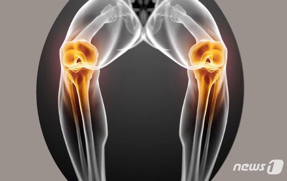 본문 이미지 - ⓒ News1 DB