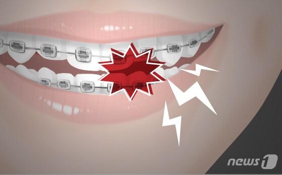 본문 이미지 - ⓒ News1 DB