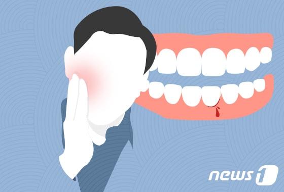 본문 이미지 - ⓒ News1 DB