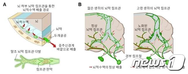 본문 이미지 - 뇌막 림프관의 위치와 연령에 따른 구조 변화 과정 모식도(IBS 제공)ⓒ 뉴스1