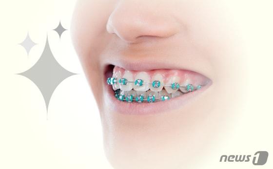 본문 이미지 - 방학 기간 평소 미뤄왔던 자녀의 치아교정을 시작하려는 부모가 많다. 아이들은 치료 초기 교정 장치에 적응하는 데 오랜 시간이 걸리는데, 방학은 치료와 학습을 병행할 수 있는 적기다. ⓒ News1 