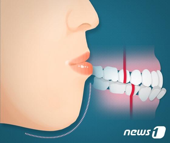 본문 이미지 - ⓒ News1 DB