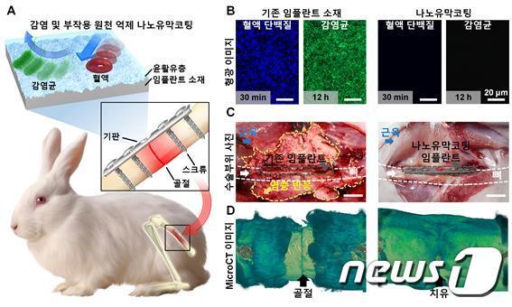 본문 이미지 - 나노유막코팅 기술의 정형외과 임플란트 응용가능성 제시 (연세대 서정목 교수 연구팀 제공) ⓒ뉴스1