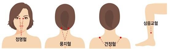 본문 이미지 - (그림제공=강동경희대병원) ⓒ 뉴스1
