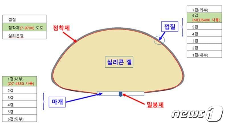 본문 이미지 - 인공유방 단면 및 허가사항과 다른 원료 사용부위(식품의약품안전처 제공)ⓒ 뉴스1