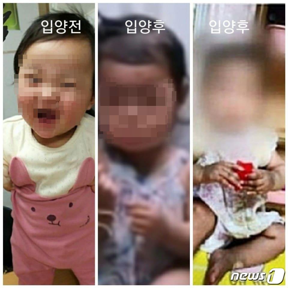 본문 이미지 - 생후 16개월 영아가 사망한 사건과 관련, 입양 전(왼쪽)과 입양 후(가운데, 오른쪽) 모습이 담긴 사진이 공개됐다. 2020.11.17/뉴스1 ⓒ 뉴스1