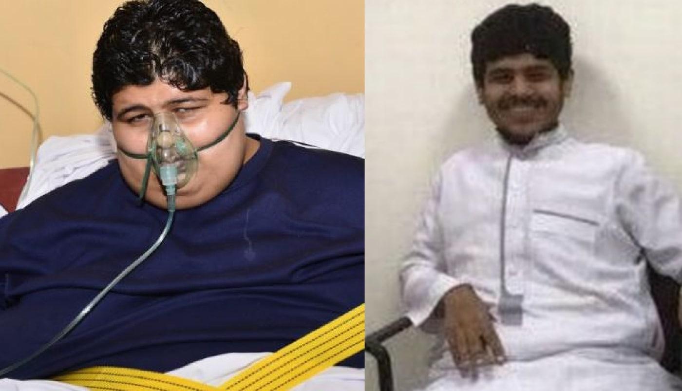 칼레드 모센 알 샤에리의 체중 감량 전후. (더선 갈무리) ⓒ 뉴스1