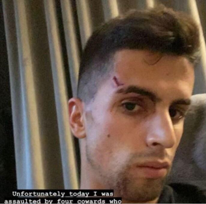 본문 이미지 - 주앙 칸셀루가 집에서 강도에게 피습을 당했다. (주앙 칸셀루 SNS 화면 캡처)