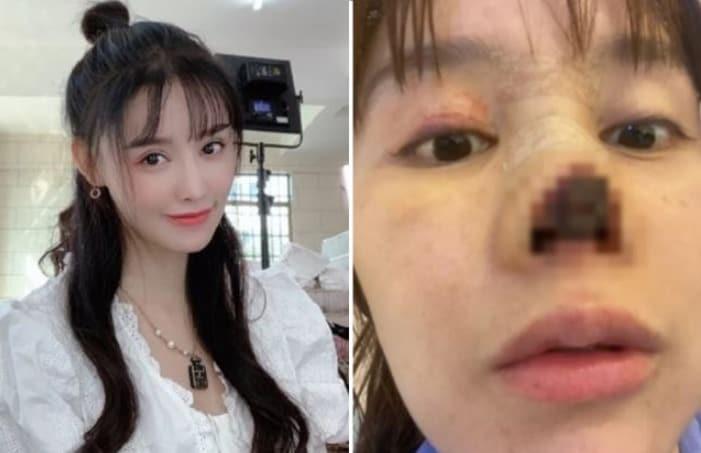 본문 이미지 - 가오류 웨이보 갈무리