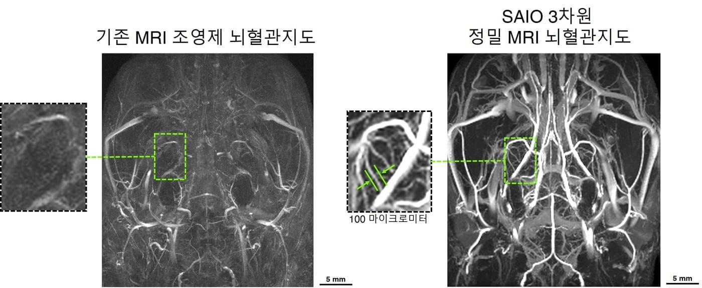 본문 이미지 - 기존 조영제와 새로운 조영제를 활용해 촬영한 뇌 혈관 사진 (기초과학연구원 제공) 2021.03.08 /뉴스1