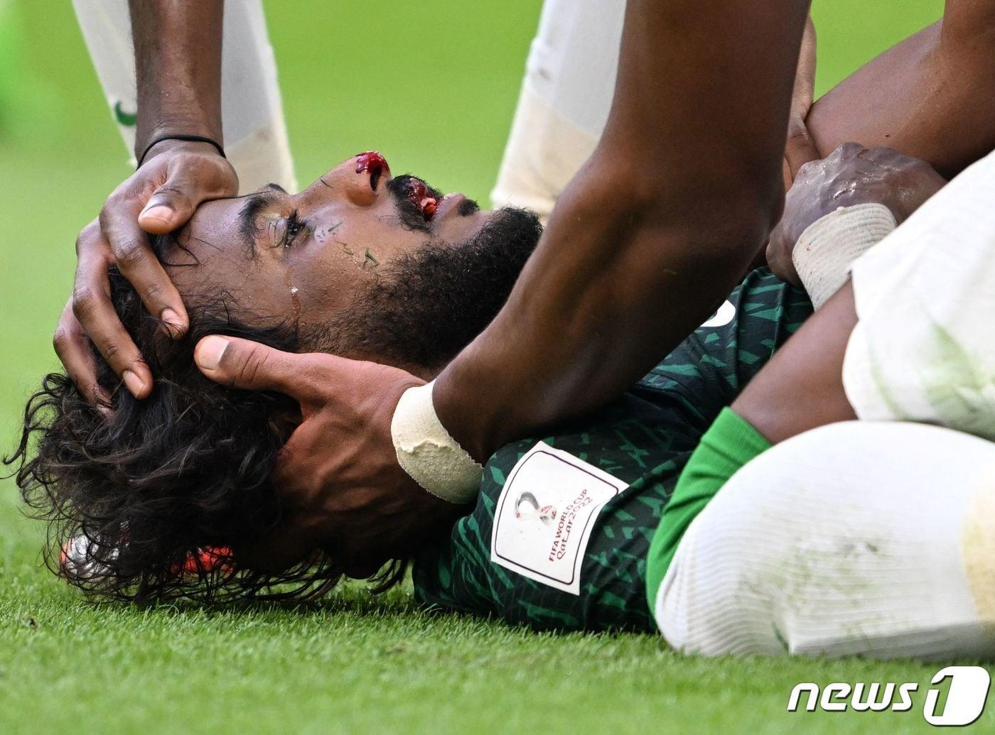 본문 이미지 - 야세르 알샤흐라니는 2022 FIFA 카타르 월드컵 조별리그 아르헨티나전에서 부상으로 쓰러졌다. ⓒ AFP=뉴스1
