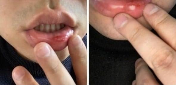 본문 이미지 - A씨가 사장한테 폭행당했다고 주장하며 올린 사진. (온라인 커뮤니티 갈무리) ⓒ 뉴스1