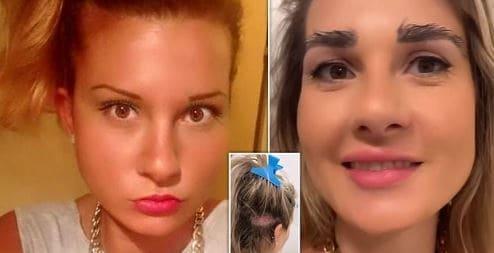 본문 이미지 - 이자벨 쿠치의 눈썹 이식 시술 전과 후. 그는 뒤통수의 머리카락을 이식했다. (트위터 갈무리) ⓒ 뉴스1