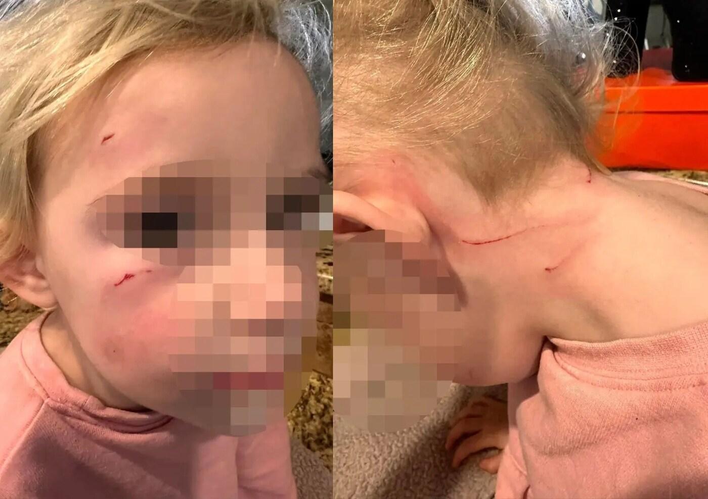 본문 이미지 - (메건 슈미트 페이스북 갈무리)